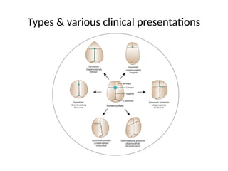 Types & various clinical presentations
 