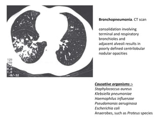 Bronchopneumonia. CT scan
consolidation involving
terminal and respiratory
bronchioles and
adjacent alveoli results in
poorly defined centrilobular
nodular opacities
Causative organisms :-
Staphylococcus aureus
Klebsiella pneumoniae
Haemophilus influenzae
Pseudomonas aeruginosa
Escherichia coli
Anaerobes, such as Proteus species
 