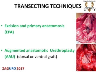 TRANSECTING TECHNIQUES
• Excision and primary anastomosis
(EPA)
• Augmented anastomotic Urethroplasty
(AAU) (dorsal or ventral graft)
 