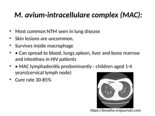 M. avium-intracellulare complex (MAC):
• Most common NTM seen in lung disease
• Skin lesions are uncommon.
• Survives inside macrophage
• • Can spread to blood, lungs,spleen, liver and bone marrow
and intestines in HIV patients
• • MAC lymphadenitis predominantly - children aged 1-4
years(cervical lymph node)
• Cure rate 30-85%
https://breathe.ersjournals.com
 
