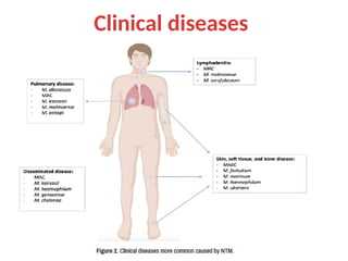 Clinical diseases
 