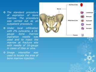  The standard procedure
of aspiration of bone
marrow. The procedure
was carried out as an
outpatient procedure.
 Under local infiltration
with 2% xylocaine, a 16-
gauge bone marrow
aspiration needle was
used and to inject the
marrow at fracture site
with needle of 16-gauge
in cases of tibia or ulna.
 Image intensifier was
used to locate the area of
bone marrow injection.
 