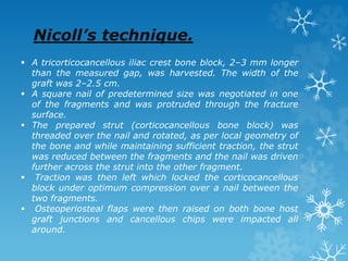 Nicoll’s technique.
 A tricorticocancellous iliac crest bone block, 2–3 mm longer
than the measured gap, was harvested. The width of the
graft was 2–2.5 cm.
 A square nail of predetermined size was negotiated in one
of the fragments and was protruded through the fracture
surface.
 The prepared strut (corticocancellous bone block) was
threaded over the nail and rotated, as per local geometry of
the bone and while maintaining sufficient traction, the strut
was reduced between the fragments and the nail was driven
further across the strut into the other fragment.
 Traction was then left which locked the corticocancellous
block under optimum compression over a nail between the
two fragments.
 Osteoperiosteal flaps were then raised on both bone host
graft junctions and cancellous chips were impacted all
around.
 