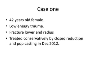 Case one 
• 42 years old female. 
• Low energy trauma. 
• Fracture lower end radius 
• Treated conservatively by closed reduction 
and pop casting in Dec 2012. 
 