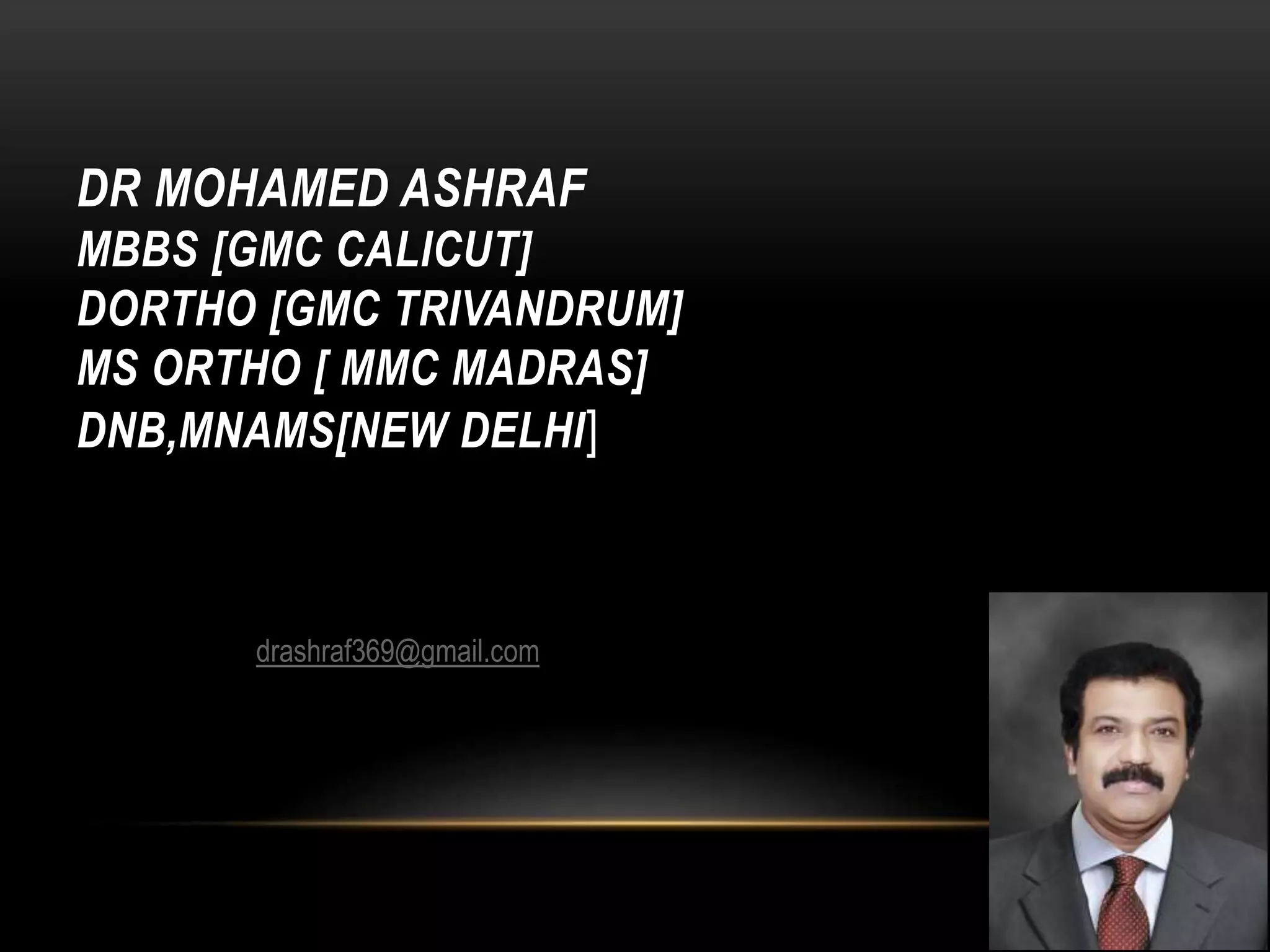 Non union of fractures dr mohamed ashraf,HOD orthopaedics,govt TD ...