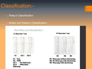 Nonunion ppt | PPTX