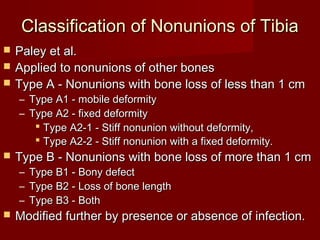 Nonunions of long bones akbar | PPT