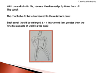 With an endodontic file , remove the diseased pulp tissue from all  The canal. The canals should be instrumented to the resistance point Each canal should be enlarged 3 – 4 instrument sizes greater than the First file capable of working the apex Cleaning and shaping 