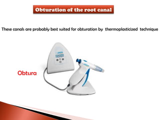 These canals are probably best suited for obturation by  thermoplasticized  technique Obtura Obturation of the root canal 