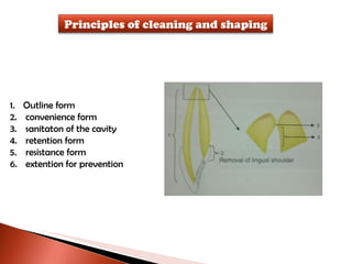Outline form convenience form sanitaton of the cavity retention form resistance form extention for prevention Principles of cleaning and shaping 
