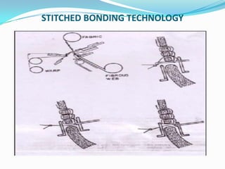 STITCHED BONDING TECHNOLOGY
 