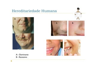 Hereditariedade Humana

 A

                         A       B




     B




     A - Dominante   A       B
     B - Recessivo
 