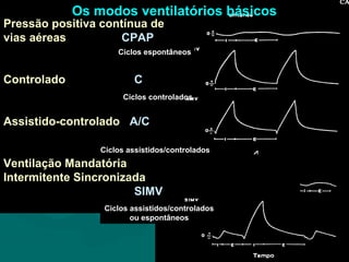 Pressão positiva contínua de
vias aéreas CPAP
Controlado C
Assistido-controlado A/C
Ventilação Mandatória
Intermitente Sincronizada
SIMV
Ciclos espontâneos
Ciclos controlados
Ciclos assistidos/controlados
Ciclos assistidos/controlados
ou espontâneos
Os modos ventilatórios básicos
 