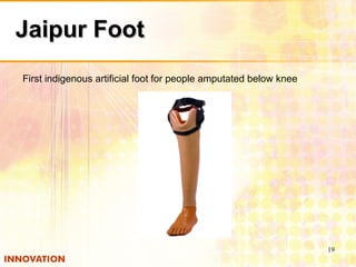 Jaipur Foot First indigenous artificial foot for people amputated below knee 