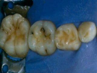 Los Niños no Olvidan. Parte 4