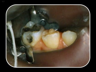 Los Niños no Olvidan. Parte 4