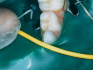 Los Niños no Olvidan. Parte 4