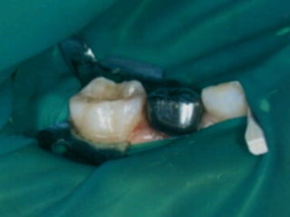 Los Niños no Olvidan. Parte 4