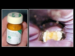 Los Niños no Olvidan. Parte 4