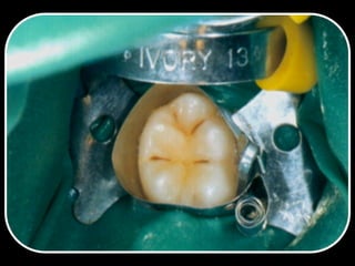 Los Niños no Olvidan. Parte 4