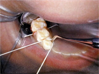 Los Niños no Olvidan. Parte 4