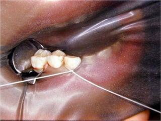 Los Niños no Olvidan. Parte 4