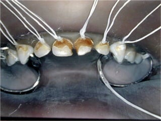 Los Niños no Olvidan. Parte 4