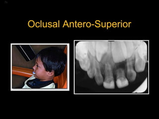 Los Niños no Olvidan. Parte 4