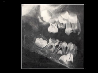 Los Niños no Olvidan. Parte 4