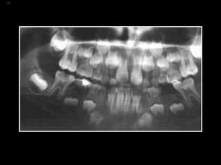 Los Niños no Olvidan. Parte 4