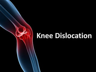 Knee Dislocation
 