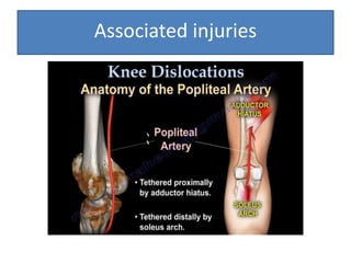 Associated injuries
 