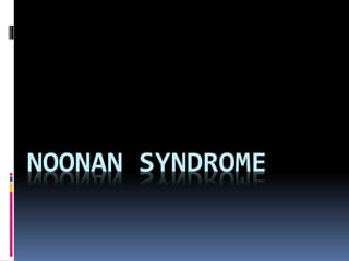 NOONAN SYNDROME 
 