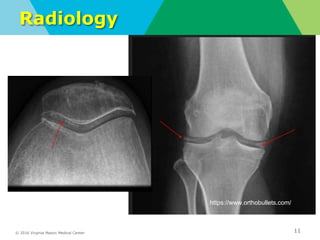 © 2016 Virginia Mason Medical Center
Radiology
11
https://www.orthobullets.com/
 