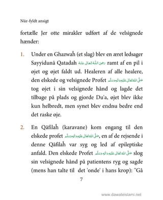 Nūr-fyldt ansigt
7
fortælle Jer otte mirakler udført af de velsignede
hænder:
1. Under en Ghazwaĥ (et slag) blev en æret ledsager
Sayyidunā Qatadah ‫ اﻟ‬ َ
ِ5َ‫ر‬‫ـ‬‫ﻠ‬‫ـ‬َ‫ﺗ‬  ُ‫ﻪ‬‫ـ‬َ‫ﻌ‬‫ـ‬ْ‫ـﻨ‬َ‫ ﻋ‬ ٰ‫ﺎﱃ‬‫ـ‬ُ‫ﻪ‬ ramt af en pil i
øjet og øjet faldt ud. Healeren af alle healere,
den elskede og velsignede Profet ٖ‫ﻪ‬ِ‫ﻟ‬ٰ‫ا‬َ‫ و‬ِ‫ﻪ‬ْ‫ﻴ‬َ‫ﻠ‬َ%  ٰ‫ﺎﱃ‬َ‫ﻌ‬َ‫ﺗ‬ ُ‫ اﷲ‬ َّ1 َ‫ﺻ‬ ‫ﻢ‬َّ‫ﻠ‬َ‫ﺳ‬َ‫و‬
tog øjet i sin velsignede hånd og lagde det
tilbage på plads og gjorde Du'a, øjet blev ikke
kun helbredt, men synet blev endnu bedre end
det raske øje.
2. En Qāfilaĥ (karavane) kom engang til den
elskede profet ٖ‫ﻪ‬ِ‫ﻟ‬ٰ‫ا‬َ‫ و‬ِ‫ﻪ‬ْ‫ﻴ‬َ‫ﻠ‬َ%  ٰ‫ﺎﱃ‬َ‫ﻌ‬َ‫ﺗ‬ ُ‫ اﷲ‬ َّ1 َ‫ﺻ‬ ‫ﻢ‬َّ‫ﻠ‬َ‫ﺳ‬َ‫و‬ , en af de rejsende i
denne Qāfilaĥ var syg og led af epileptiske
anfald. Den elskede Profet ٖ‫ﻪ‬ِ‫ﻟ‬ٰ‫ا‬َ‫ و‬ِ‫ﻪ‬ْ‫ﻴ‬َ‫ﻠ‬َ%  ٰ‫ﺎﱃ‬َ‫ﻌ‬َ‫ﺗ‬ ُ‫ اﷲ‬ َّ1 َ‫ﺻ‬ ‫ﻢ‬َّ‫ﻠ‬َ‫ﺳ‬َ‫و‬ slog
sin velsignede hånd på patientens ryg og sagde
(mens han talte til det 'onde' i hans krop): ''Gå
www.dawateislami.net
 