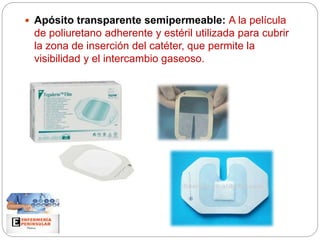 Apósito transparente semipermeable: A la película
de poliuretano adherente y estéril utilizada para cubrir
la zona de inserción del catéter, que permite la
visibilidad y el intercambio gaseoso.
 