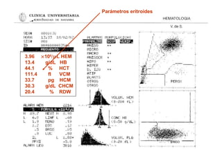 3.96 ×106
/µL HEM
13.4 g/dL HB
44.1 % HCT
111.4 fl VCM
33.7 pg HCM
30.3 g/dL CHCM
20.4 % RDW
Parámetros eritroides
 