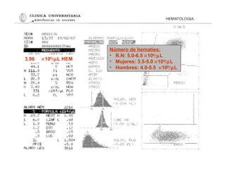 3.96 ×106
/µL HEM
Número de hematíes:
• R.N: 5.0-6.5 ×106
/µL
• Mujeres: 3.5-5.0 ×106
/µL
• Hombres: 4.0-5.5 ×106
/µL
 