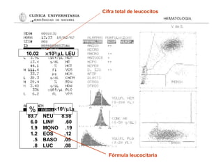 10.02 ×103
/µL LEU
89.7 NEU 8.98
6.0 LINF .60
1.9 MONO .19
1.2 EOS .12
.5 BASO .05
.8 LUC .08
% ×103
/µL
Fórmula leucocitaria
Cifra total de leucocitos
 