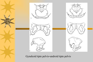 Gynekoid tipte pelvis - android tipte pelvis 