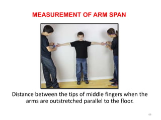 Arms Length Distance Visual Normal growth in pediatrics | PPT