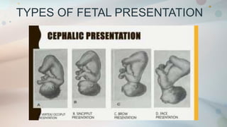 TYPES OF FETAL PRESENTATION
 
