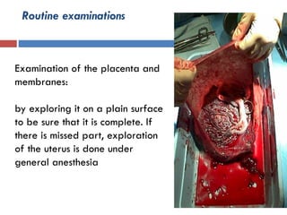 Routine examinations
Examination of the placenta and
membranes:
by exploring it on a plain surface
to be sure that it is complete. If
there is missed part, exploration
of the uterus is done under
general anesthesia
 