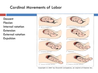 Descent
Flexion
Internal rotation
Extension
External rotation
Expulsion
Cardinal Movements of Labor
 