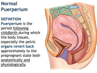 Normal
Puerperium
DEFINITION
Puerperium is the
period following
childbirth during which
the body tissues,
especially the pelvic
organs revert back
approximately to the
prepregnant state both
anatomically and
physiologically.
 