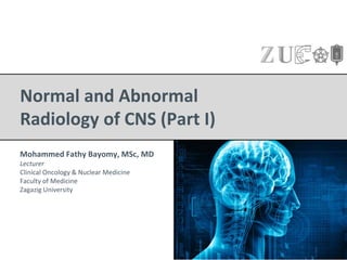 Normal and Abnormal
Radiology of CNS (Part I)
Mohammed Fathy Bayomy, MSc, MD
Lecturer
Clinical Oncology & Nuclear Medicine
Faculty of Medicine
Zagazig University
 