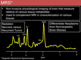 Mrs. Brain Example Normal & abnormal radiology of brain part ii | PPTX