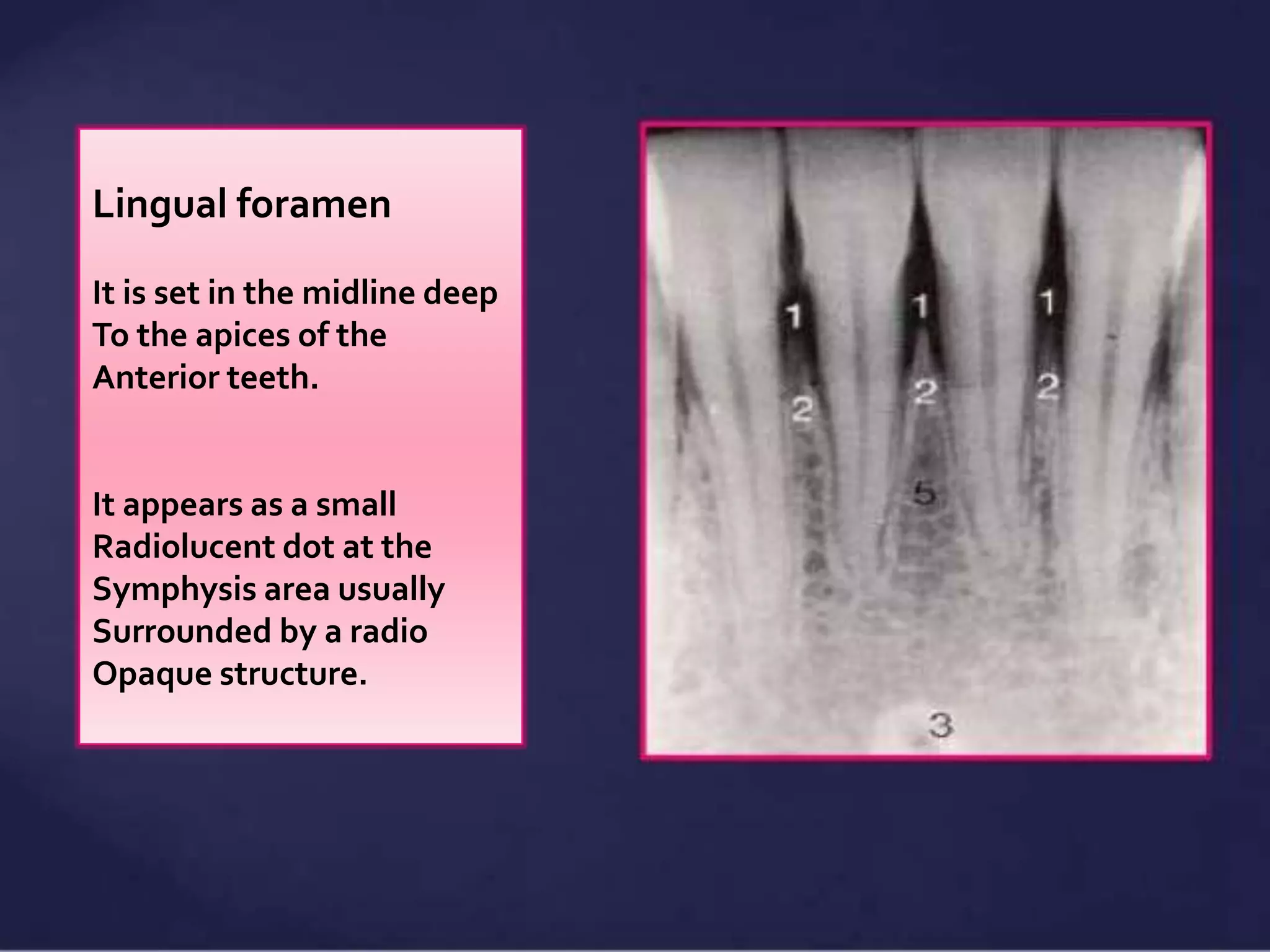 Normal Radiographic Anatomical Landmarks PPTX normal-radiographic-anatomical-landmarks-pptx