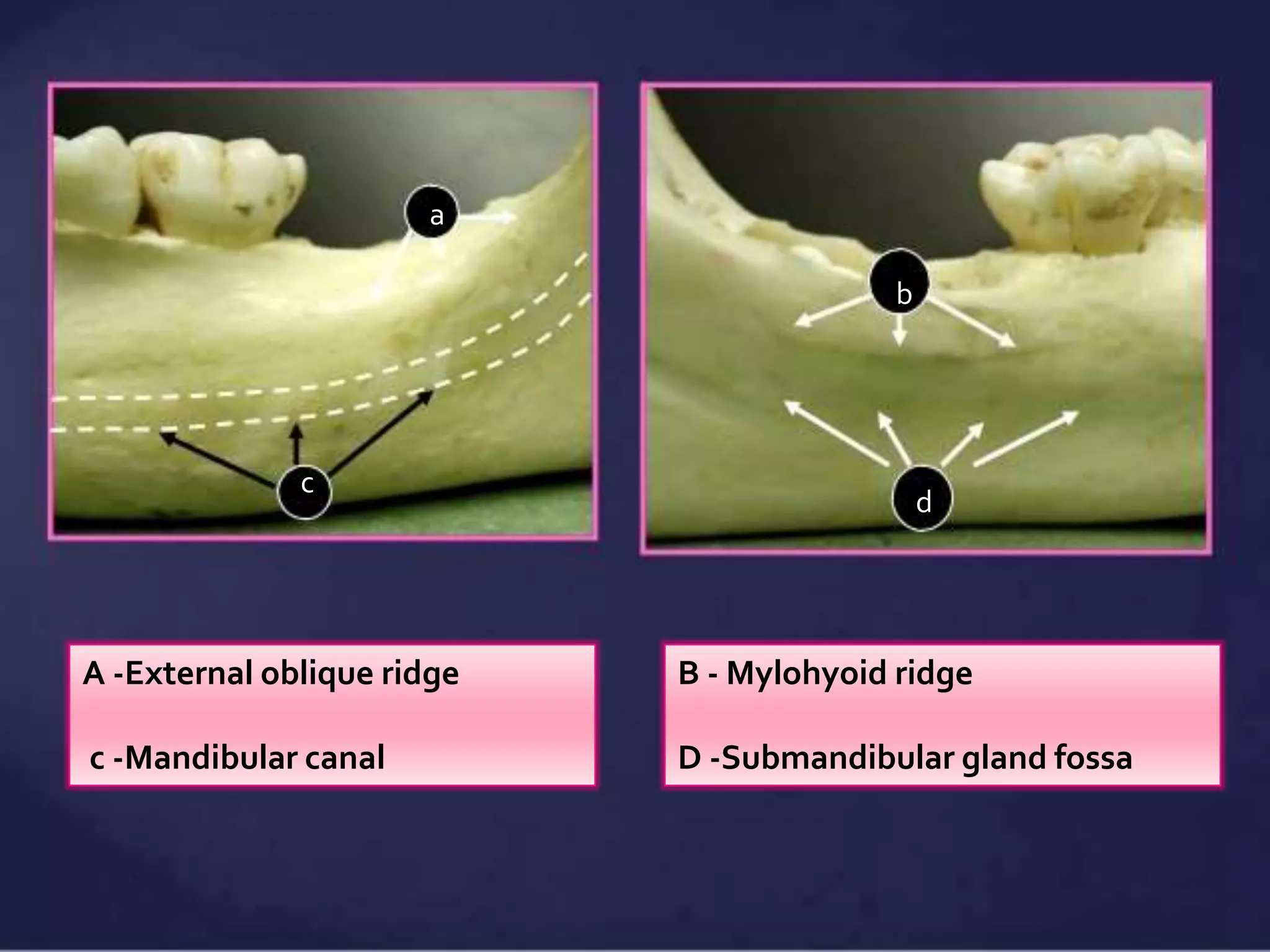 Normal Radiographic Anatomical Landmarks | PPTX