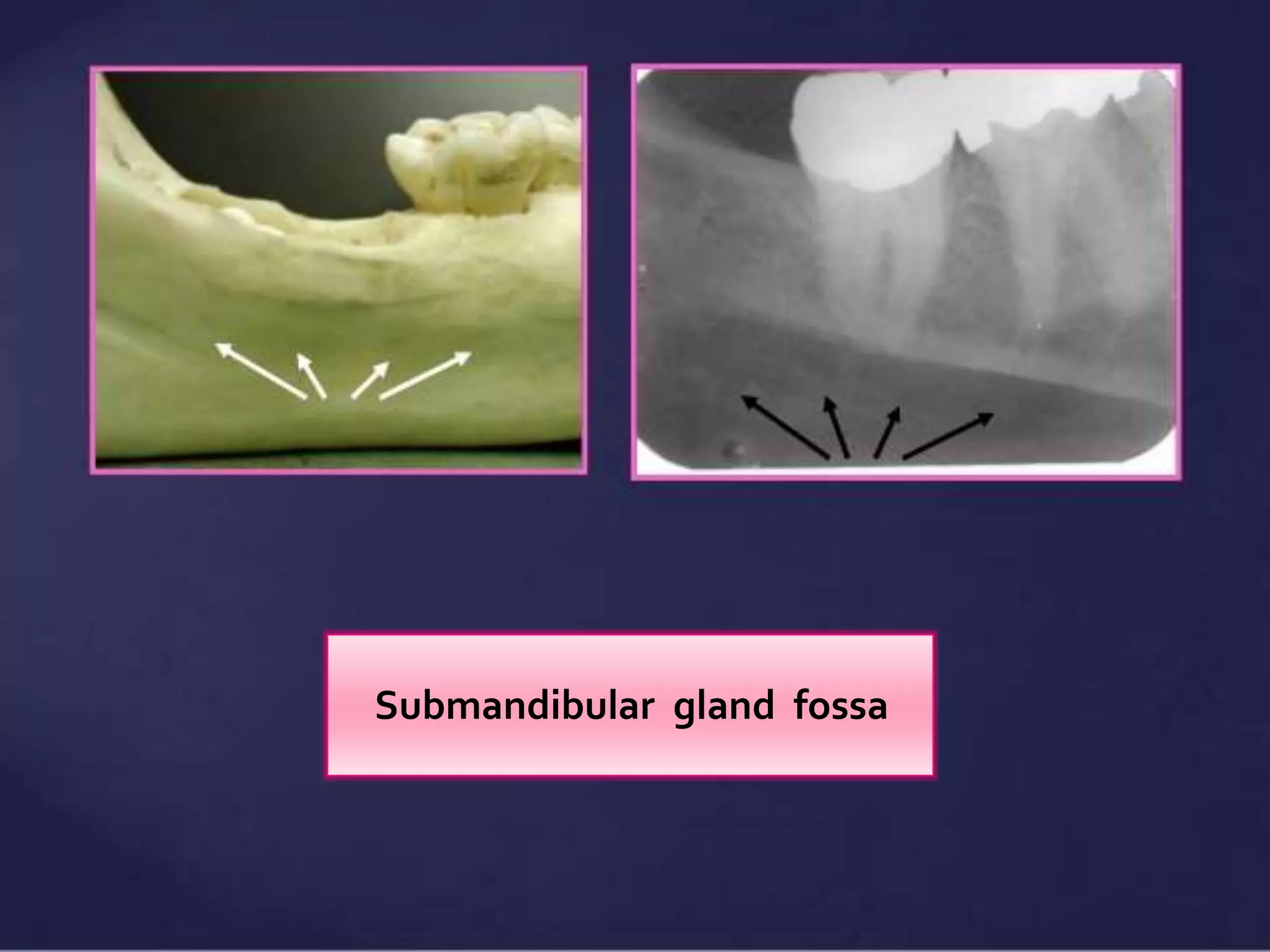 Normal Radiographic Anatomical Landmarks PPTX